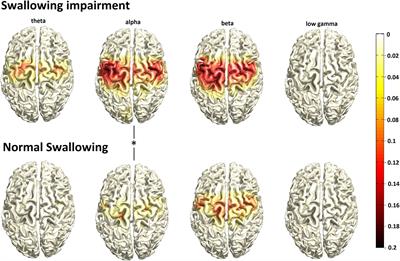 Clinical determinants and neural correlates of presbyphagia in community-dwelling older adults